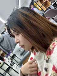 体验前-郡艺医疗美容·微整·眼鼻吸脂