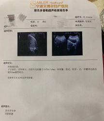 -艾博尔医院