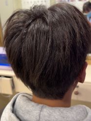 -碧莲盛·不剃发植发