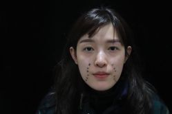 -洁铭新加坡医美