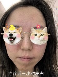体验后-加减美医美连锁品牌