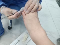 -Andrew指甲专科灰指甲·甲沟炎矫正·3D步态矫形鞋垫定制(浦三路店)