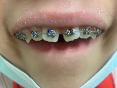 -北京大学口腔医院(第一门诊部)