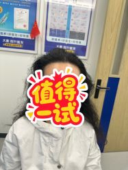 -大麦微针植发全国连锁