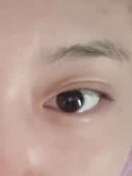 -天津健丽·去眼袋医疗美容机构