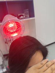 -大麦微针植发全国连锁