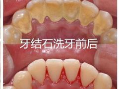-团圆口腔·种植中心(锦江院区)