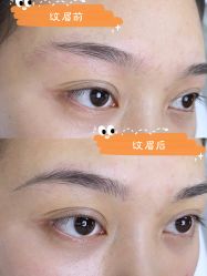 -OnFaer.纹眉半永久无创洗眉