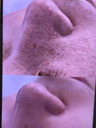 -SKIN79皮肤管理中心