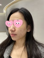 体验后-美瑞莎创美医疗美容