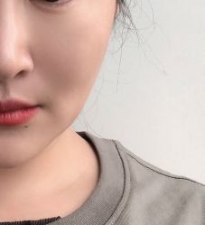 体验后-深圳阳光医疗美容医院·旗舰店