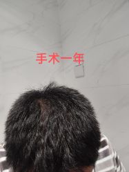 -北京雍禾植发医院