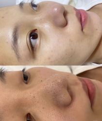 -SKIN79皮肤管理中心