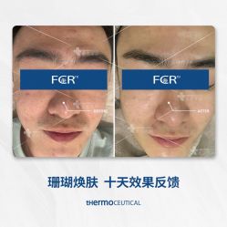 -苗方清颜痘肌研究所