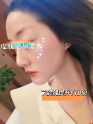 -Yestar艺星整形美容医院