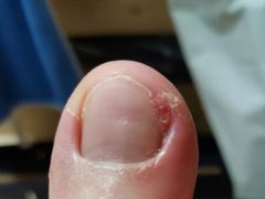 -新甲连锁灰指甲·甲沟炎·鸡眼(黑龙江路店)