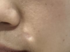 -南方医科大学深圳医院