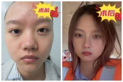 -素美医疗美容·西南眼鼻整形·修复基地