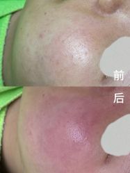 -苗医生0感祛痘连锁