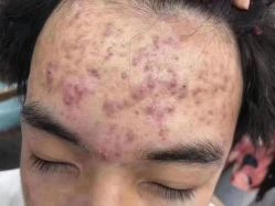 -禾壹净·素颜美问题肌肤修护中心