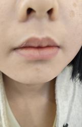 -长沙雅美医疗美容医院