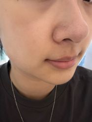 -AiCure 埃可儿·韩国医学皮肤管理