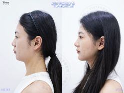 -Yestar艺星整形美容医院
