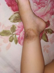 -丽美妍医疗美容·皮秒·立体分层抗衰