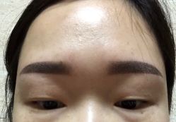 -郡艺医疗美容·微整·眼鼻吸脂