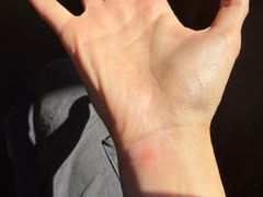 -正宗杨记普洱酸醋米线(总店)