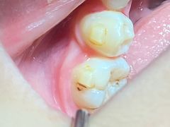 -艾维口腔(春江花月门诊部)