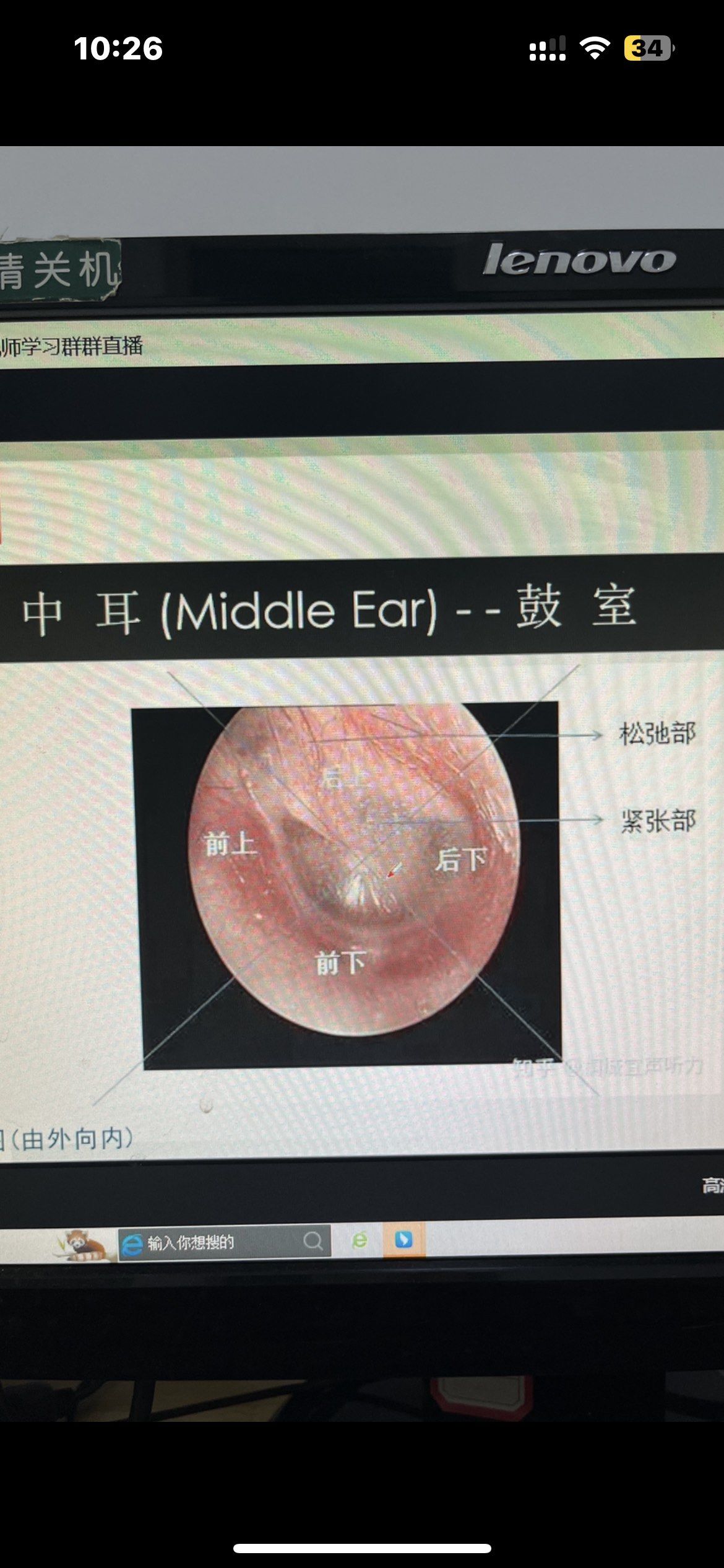 随着外耳道压力,探测声频率,声刺激强度等参数的改变,鼓膜,听骨链