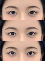 点击看大图 -杨益美学·野生眉半永久纹眉发际线