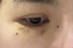 -慕颜医疗美容·皮肤微整 抗衰