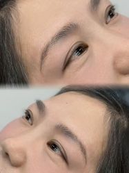 点击看大图 -张小野·专业半永久纹眉