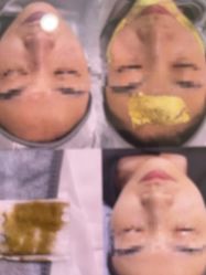 -skin79皮肤管理中心