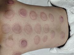 -金蚁康•经络调理•肩颈按摩(万达金街店)