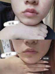 -弘美医美·艾维岚童颜抗衰中心