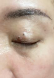 -北京楚诺医疗美容