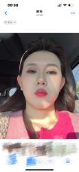 -上海伊莱美医疗美容医院