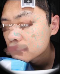 -韩国淼美颜皮肤管理官方直营店