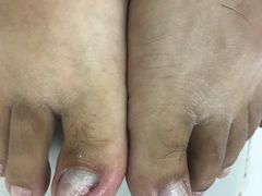 -新甲连锁灰指甲·甲沟炎·鸡眼(黑龙江路店)