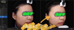 -肌密·水光·祛痘·黄金微针