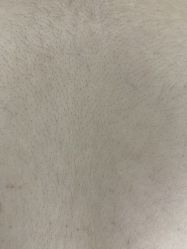 -薇兰专业脱毛连锁机构