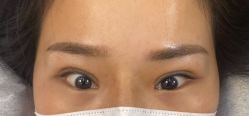 体验后-天津伊美尔医疗整形美容专科医院