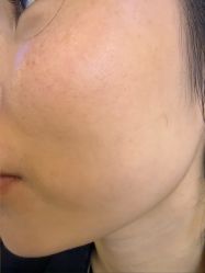 -长沙雅美医疗美容医院