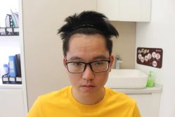 点击看大图 -大麦微针植发丨全国连锁