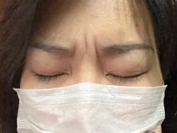 点击看大图 体验前-四川娇点医学美容医院
