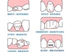 -团圆口腔·种植中心(锦江院区)