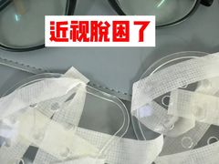 -黑马眼科·近视手术